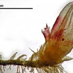 Cephaloziella spinigera - gynoecium