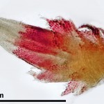 Cephaloziella spinigera - perianth