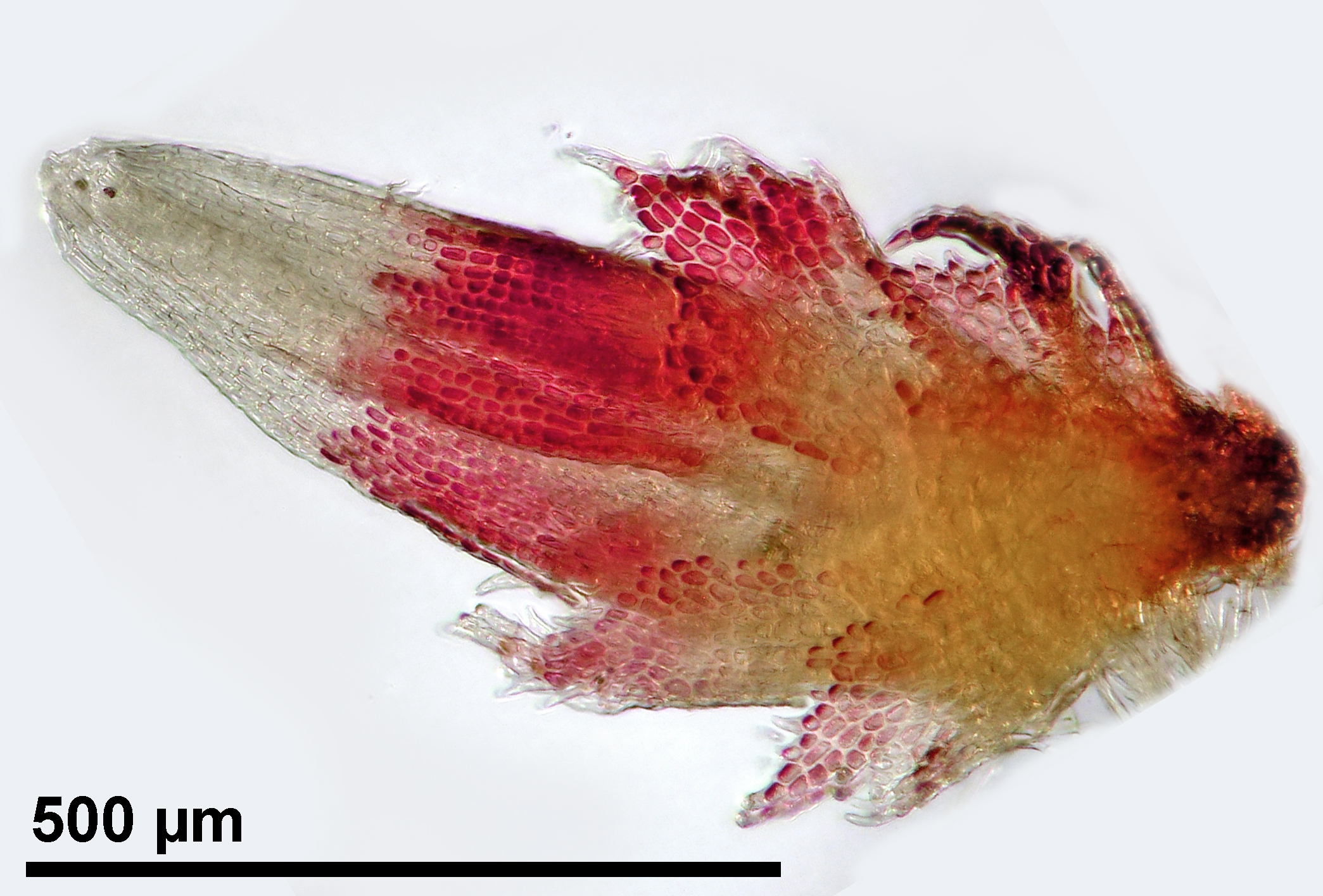 Cephaloziella spinigera - perianth