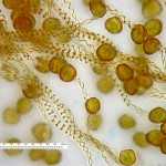 Haplomitrium hookeri - spores and elaters